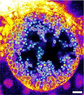 Novel trifunctional sphingomyelins (TFSM) can be used to visualise Chlamydia inclusions within infected human cells and enables the detection of native sphingomyelin derivatives in non-infectious reticulate bodies (yellow circles) and metabolized sphingomyelin derivatives in infectious elementary bodies (green dots). (Image: Jürgen Seibel / Universität Würzburg) 