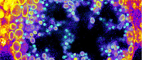 Novel trifunctional sphingomyelins (TFSM) can be used to visualise Chlamydia inclusions within infected human cells and enables the detection of native sphingomyelin derivatives in non-infectious reticulate bodies (yellow circles) and metabolized sphingomyelin derivatives in infectious elementary bodies (green dots). (Image: Jürgen Seibel / Universität Würzburg) 